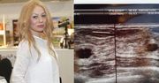 Monika Jarosińska pokazała badanie piersi!