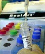 W Polsce nie ma SARS