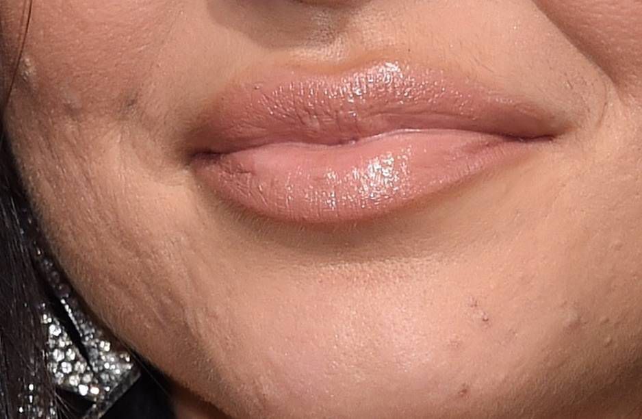 Cera Kendall Jenner, Złote Globy 2018
