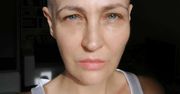 Anna Puślecka pokazała swój "posiłek" za 600 złotych. Tak wygląda śniadanie chorej na raka gwiazdy