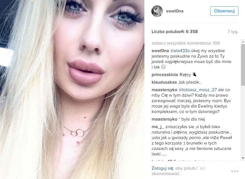 Ewelina z Warsaw Shore znów poddała się zabiegowi medycyny estetycznej
