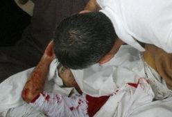 Po krwawym ostrzale dziennikarzy Pentagon wyraża żal