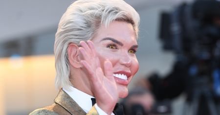 Rodrigo Alves zmienił płeć. "Żywy Ken" teraz jest jak Barbie