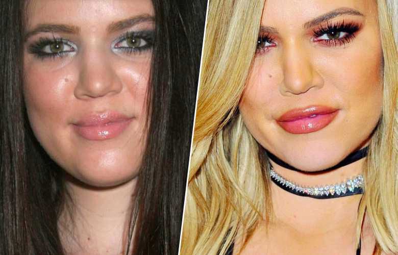 Khloe Kardashian – nosKendall Jenner – nos
