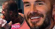 David Beckham pokazał się po przeszczepie włosów! Różnica jest gigantyczna!