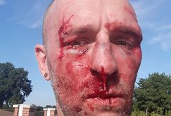 Przemysław Witkowski został pobity. "Nie przesadzałbym, że mamy do czynienia z falą terroru"