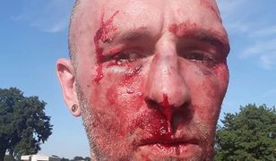 Przemysław Witkowski został pobity. "Nie przesadzałbym, że mamy do czynienia z falą terroru"