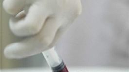 Koszty przygotowań mogą sięgać miliardów dolarów