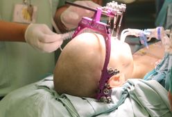 9-letni chłopiec nie ma oczu i nosa. Lekarze w końcu mogą mu pomóc