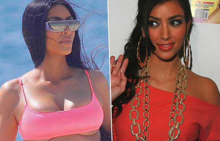 Kim Kardashian - po i przed operacją biustu