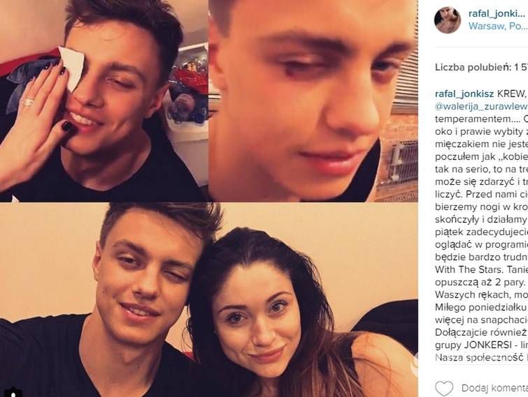 Rafał Jonkisz miał wypadek na próbie Tańca z gwiazdami