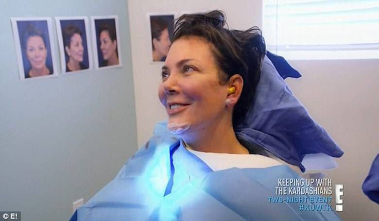 Kris Jenner zmniejszyła sobie uszy