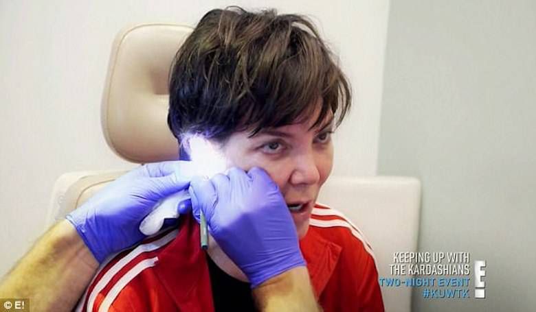 Kris Jenner zmniejszyła sobie uszy