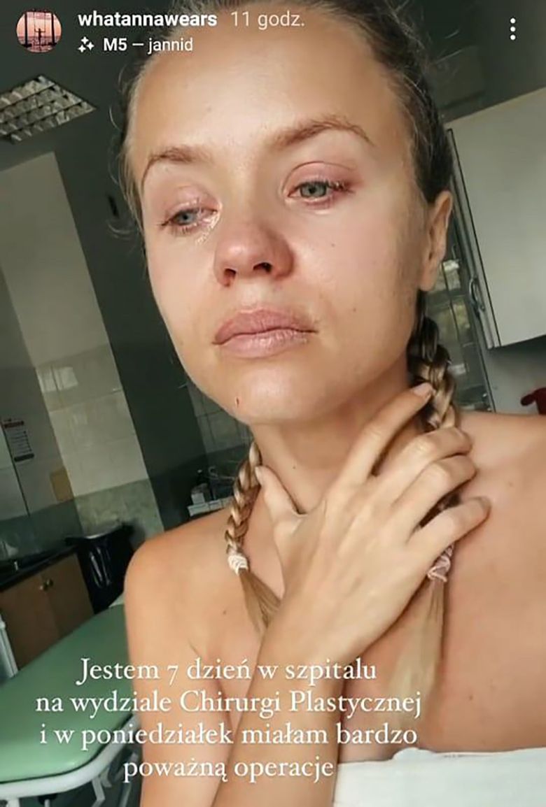 Anna Skura przeszła poważną operację
