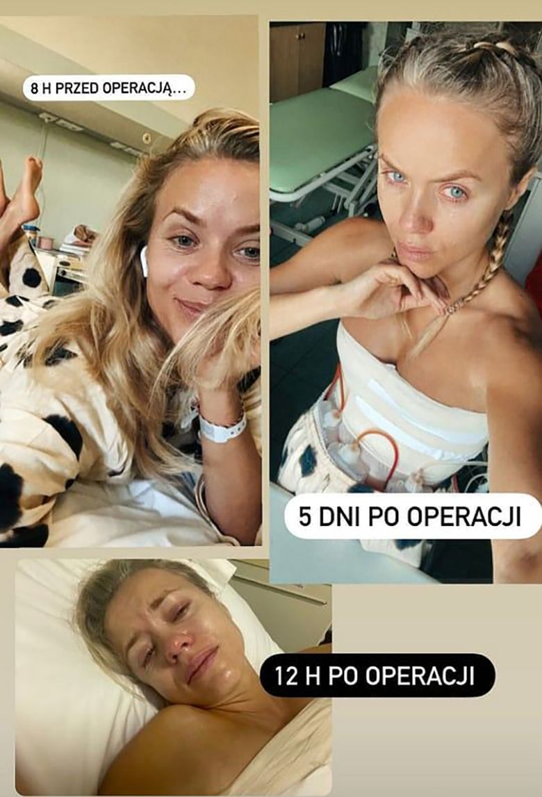 Anna Skura przeszła poważną operację