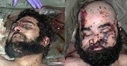 Zdjęcia martwych synów Saddama mają sens