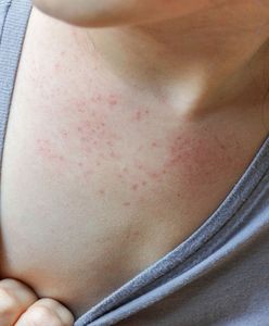 Odra śmiertelnym zagrożeniem. Problem idzie z Ukrainy