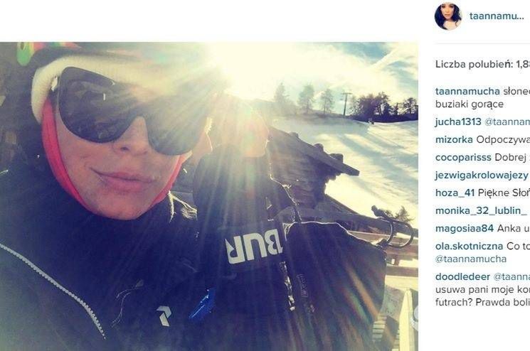 Anna Mucha zrobiła sobie usta?