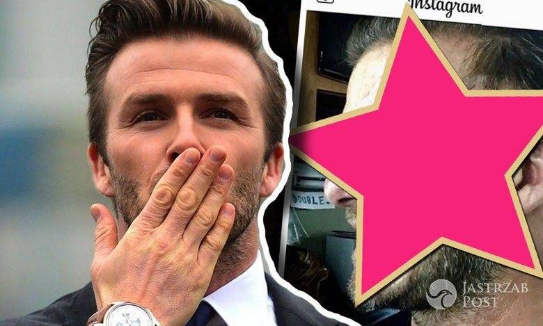David Beckham pokazał przerażające zdjęcie! Co mu się stało?