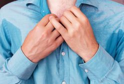 Potliwość dłoni - jak leczyć nadpotliwość?