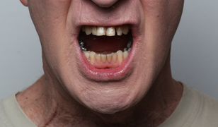 Jakub Majmurek: co zrobić z mową nienawiści?