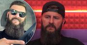 Radek z Big Brothera pokazał zmasakrowany palec po wypadku! Zdjęcie tylko dla osób o mocnych nerwach