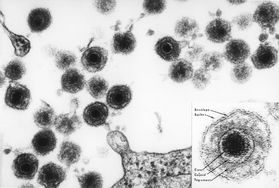 Mikrofotografia wirusa HHV-6
