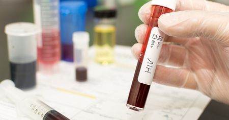 HIV nie daje objawów przez wiele lat. Każdy powinien wykonać test!