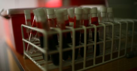 Wirus HIV atakuje Europę. Największa liczba nowych zakażeń w historii