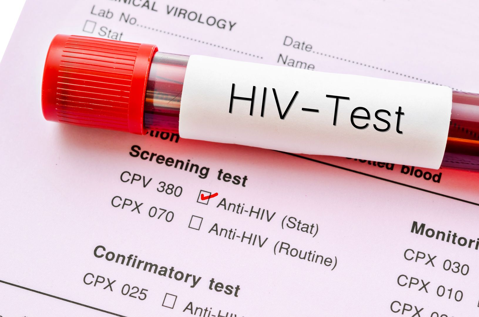 Prof. Izdebski alarmuje: Polacy oswoili się z HIV, odczuwają mniejszy lęk przed zarażeniem