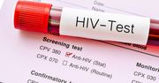 Przełom w leczeniu HIV i nadzieja dla milionów. Pierwszy raz skutecznie wyeliminowano wirusa