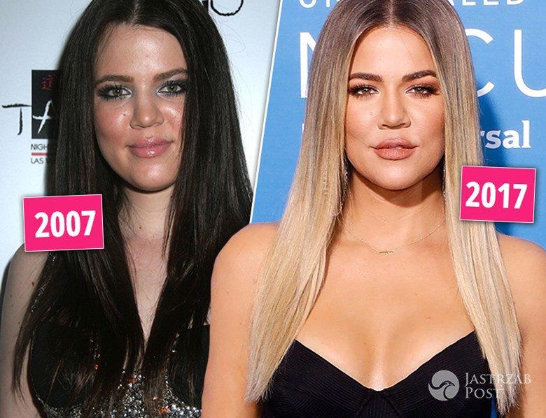 Khloe Kardashian - kiedyś i dzisiaj, metamorfoza