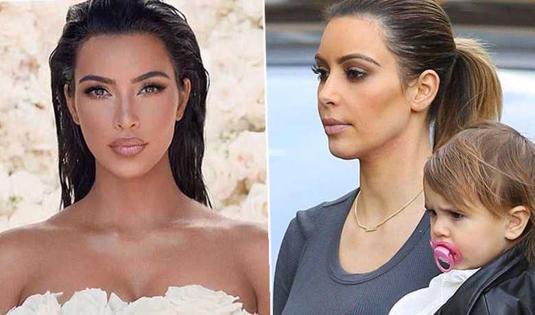 Kim Kardashian- po i przed korektą ust
