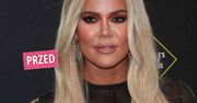 Metamorfoza Khloe Kardashian. Szokujące zdjęcia: "Kim jesteś?"