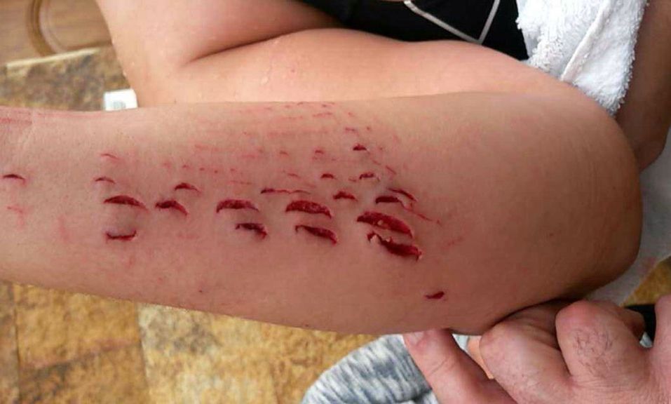 Gran Canaria - rekin zaatakował turystkę