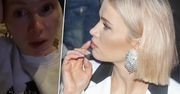 Maffashion pokazała twarz pełną niedoskonałości. Jej cera nie wygląda dobrze. Zdecydowała się na radykalne środki