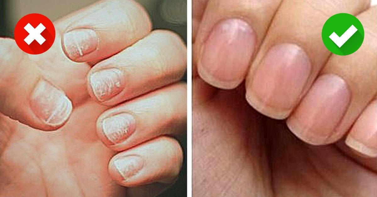 2 Ways to Safely Remove Hybrid Gel from Your Nails without Damaging Them