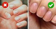 2 sposoby na bezpieczne zdejmowanie hybrydy w domu. Bez uszkodzenia płytki paznokci