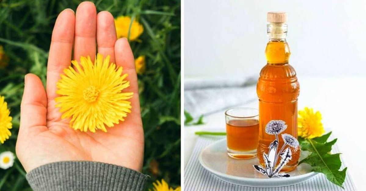 Dandelion Syrup Helps Treat Anemia and Cleanse the Body of Toxins