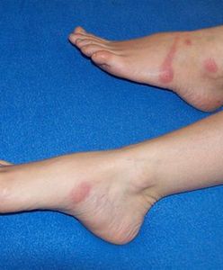 Podstępnie atakują i wstrzykują nam truciznę!