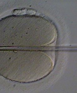 Finansowanie in vitro w Poznaniu nie dla wszystkich par