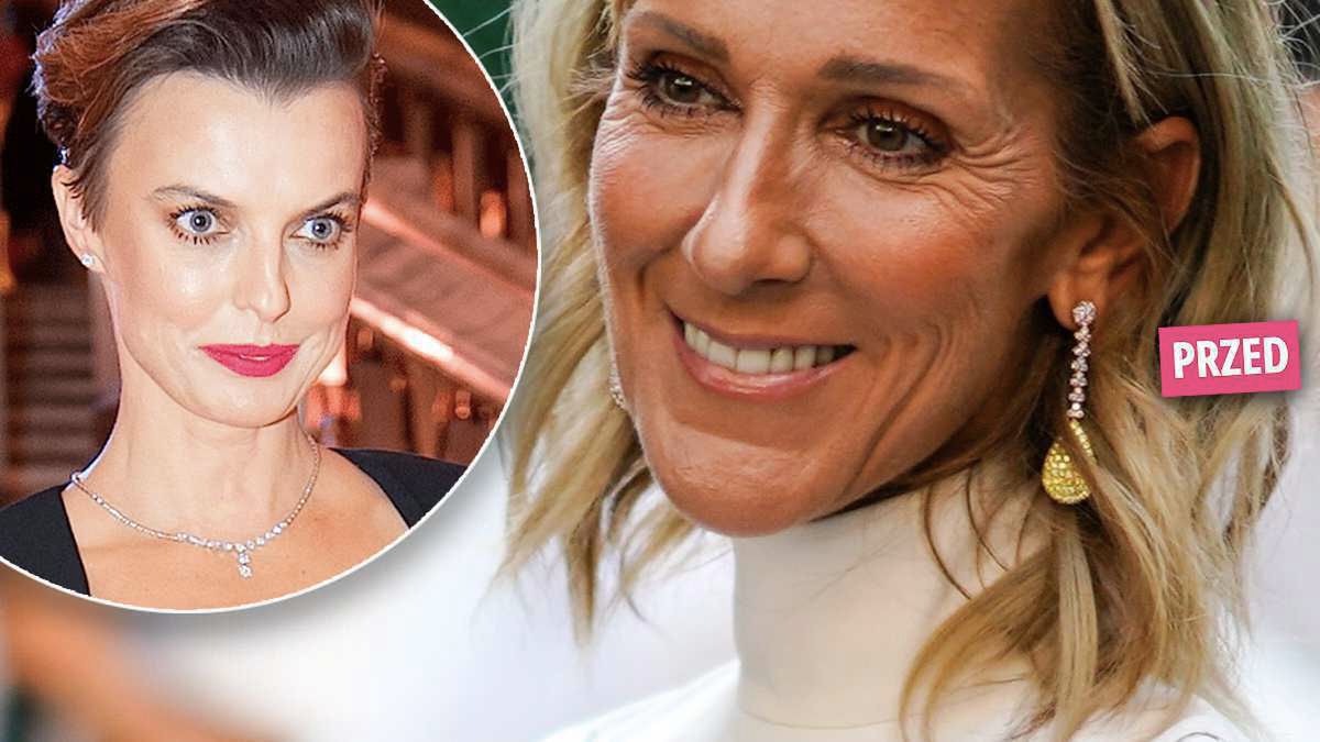 Celine Dion pokazała się w krótkich włosach i z wygładzoną twarzą! Gwiazda zmieniła się w klona Kasi Sokołowskiej!