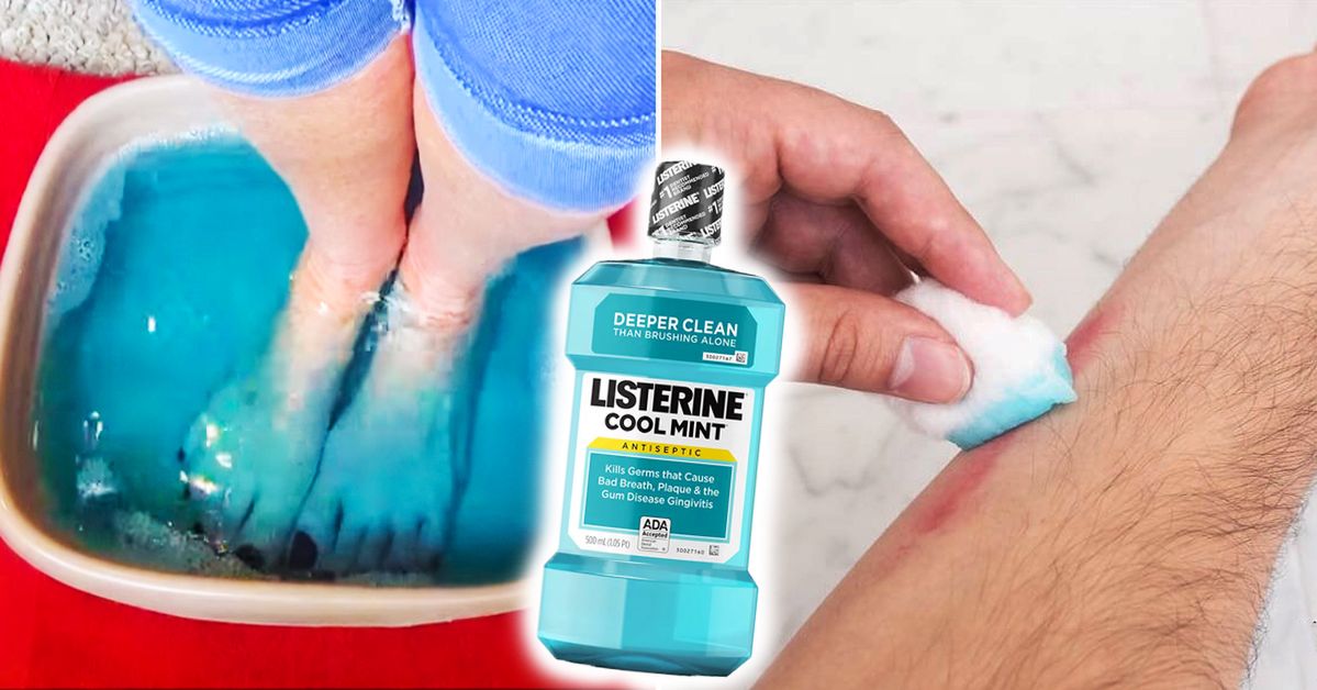 14 Unusual Applications of Mouthwash. Yes, They Do Work!