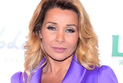 Aldona Orman ma nieruchomą twarz!