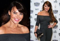 Lizzie Cundy: jej twarz staje się coraz bardziej nieruchoma!