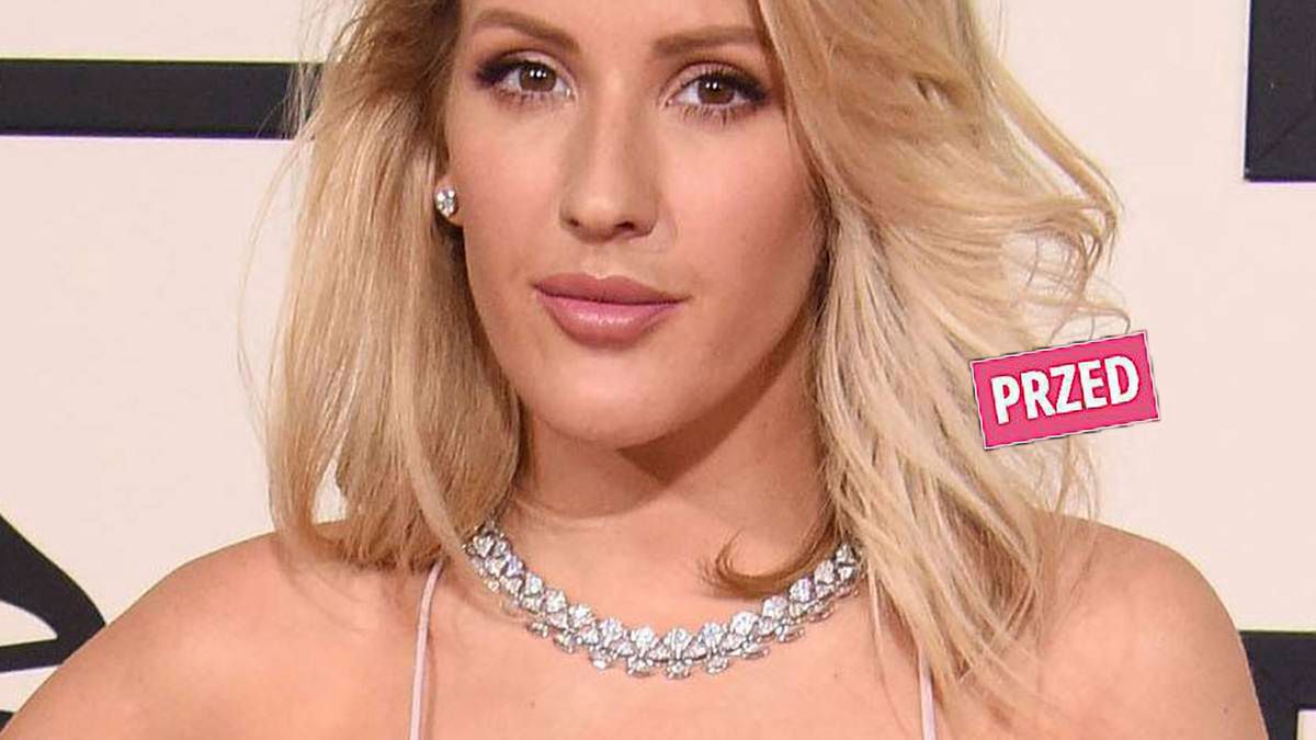 Ellie Goulding poddała się operacji plastycznej? Jej twarz zmieniła się nie do poznania. Efekty widać gołym okiem