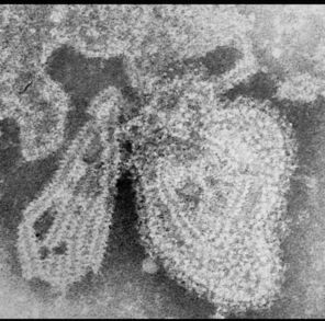 Obraz mikroskopowy wirusa świnki 