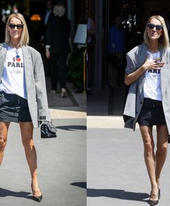 Celine Dion chwali się nogami. Są wyjątkowo szczupłe