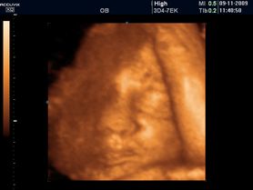 Płód w 40 tygodniu ciąży (zdjęcia 3D)