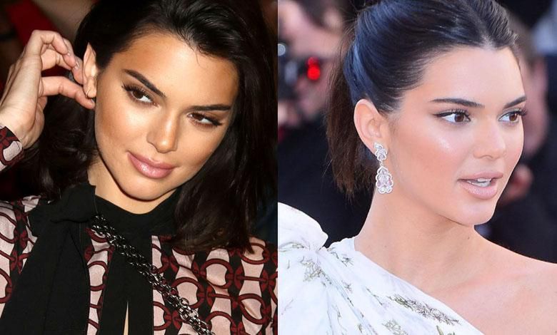 Kendall Jenner powiększyła usta